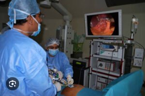 Laparoscopic Gallbladder Surgery