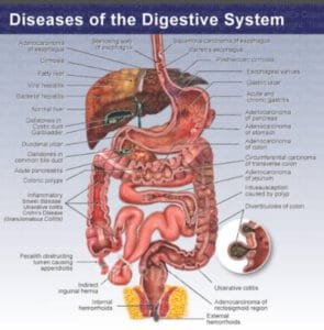 Diseases of Digestive Organs