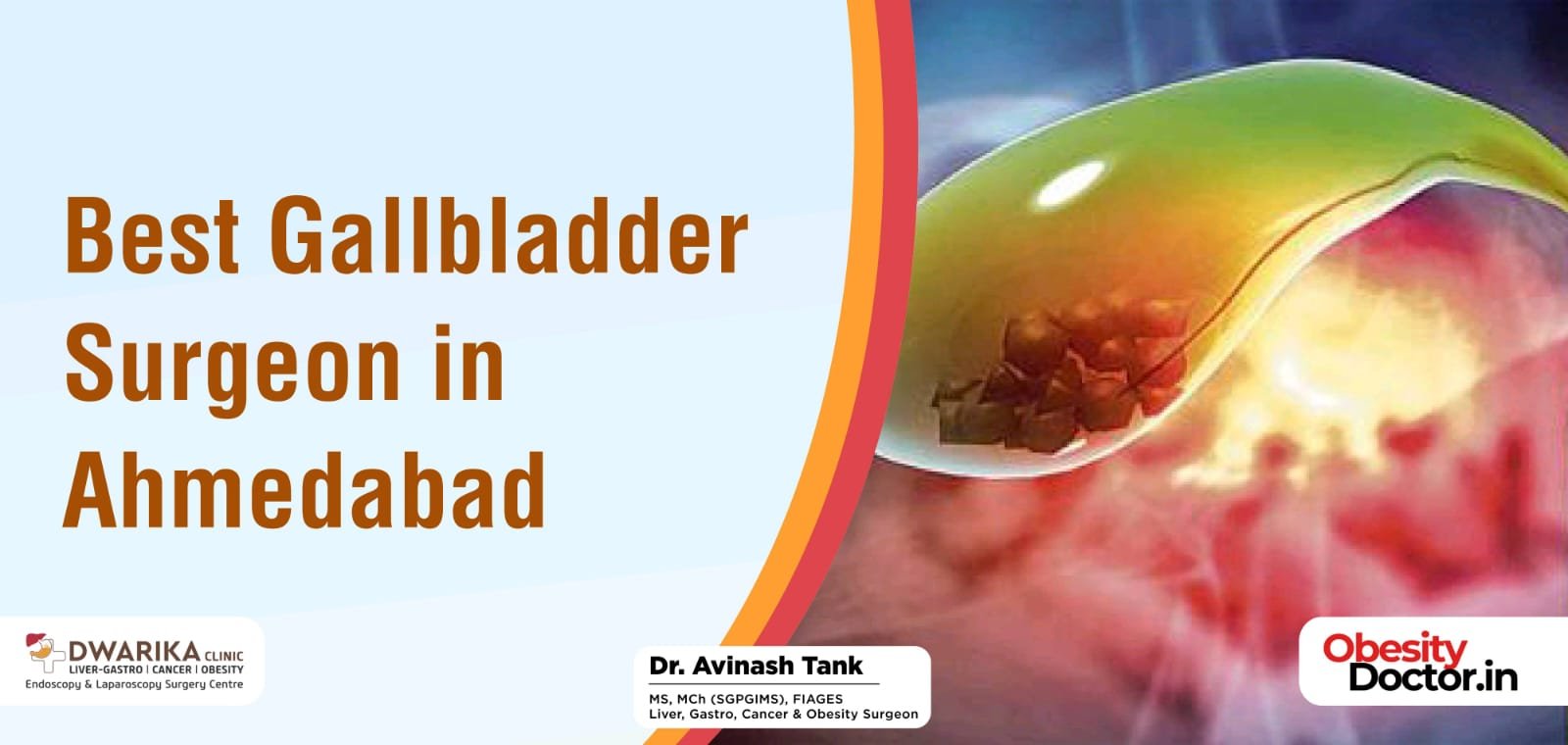 Gallbladder specialists near me