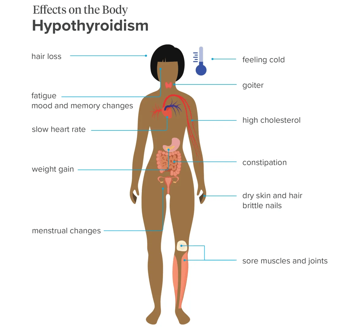 Connection Between Hypothyroidism and Constipation
