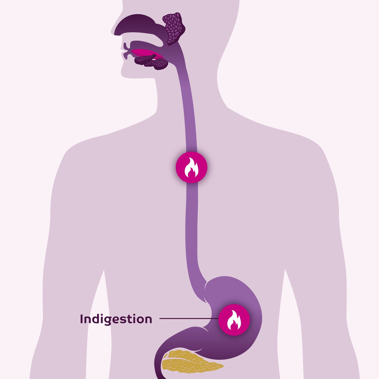 Indigestion (Dyspepsia): Causes & Treatment